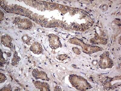 Immunohistochemistry: A-RAF Antibody (OTI2G9) [NBP2-46538]