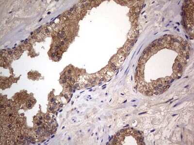 Immunohistochemistry: A-RAF Antibody (OTI2G9) [NBP2-46538]