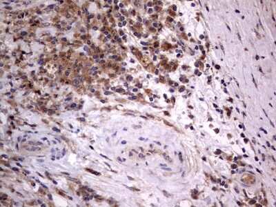 Immunohistochemistry: A-RAF Antibody (OTI2G9) [NBP2-46538]