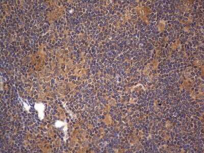 Immunohistochemistry: A-RAF Antibody (OTI2G9) [NBP2-46538]