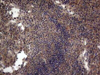 Immunohistochemistry: A-RAF Antibody (OTI2G9) [NBP2-46538]