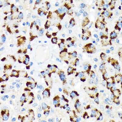 Immunohistochemistry-Paraffin: A-RAF Antibody (4U9L7) [NBP3-16677]