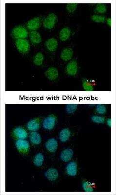 Immunocytochemistry/ Immunofluorescence: A-RAF Antibody [NBP1-33067]