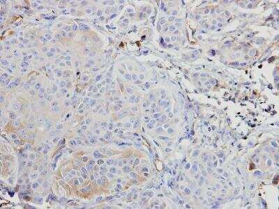 Immunohistochemistry-Paraffin: A-RAF Antibody [NBP1-33067]
