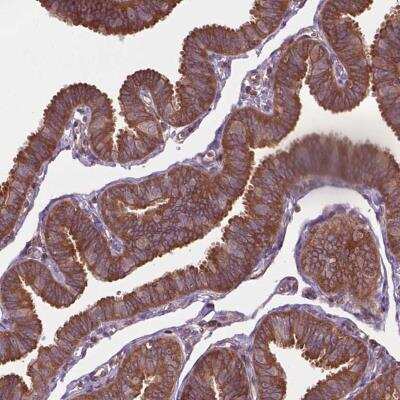 Immunohistochemistry-Paraffin: A-RAF Antibody [NBP2-49479]