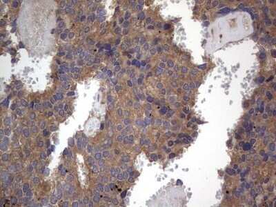 Immunohistochemistry: A-RAF Antibody (OTI2G9) - Azide and BSA Free [NBP2-70201]