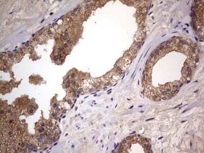 Immunohistochemistry: A-RAF Antibody (OTI2G9) - Azide and BSA Free [NBP2-70201]