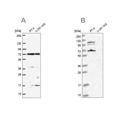 Western Blot: A-RAF Antibody [NBP2-49479]
