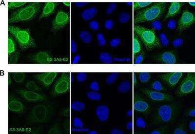 Immunocytochemistry/ Immunofluorescence: A. aeolicus BPL/BioID2 Antibody (SS 3A5-E2) - BSA Free [NBP2-59941]