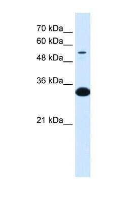 Western Blot: alpha 1B-Glycoprotein Antibody [NBP1-57965]