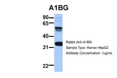 Western Blot: alpha 1B-Glycoprotein Antibody [NBP1-57965]