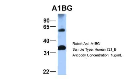 Western Blot: alpha 1B-Glycoprotein Antibody [NBP1-57965]