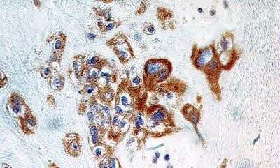 Immunohistochemistry: A20/TNFAIP3 Antibody (59A426) - Azide Free [NBP2-33252]