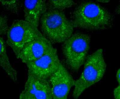 Immunocytochemistry/ Immunofluorescence: A20/TNFAIP3 Antibody (SN07-31) [NBP2-67676]
