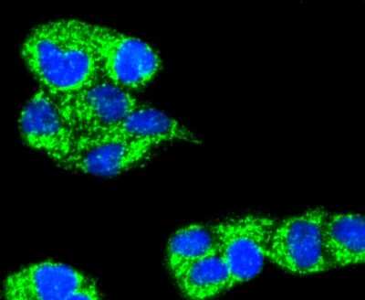 Immunocytochemistry/ Immunofluorescence: A20/TNFAIP3 Antibody (SN07-31) [NBP2-67676]