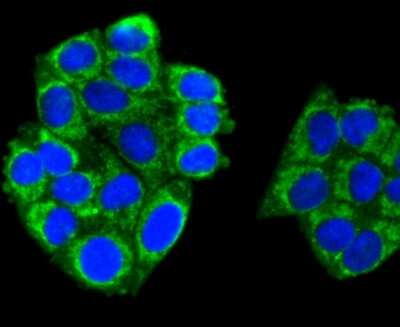 Immunocytochemistry/ Immunofluorescence: A20/TNFAIP3 Antibody (SN07-31) [NBP2-67676]