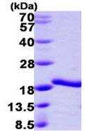 SDS-PAGE: Recombinant Human A2LD1 His Protein [NBP1-78799]