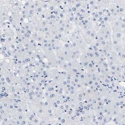 Immunohistochemistry-Paraffin: A33/GPA33 Antibody [NBP1-89332]