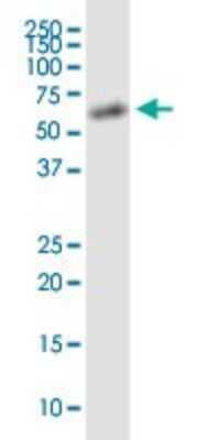 Western Blot: AAAS Antibody (5A1) [H00008086-M02]