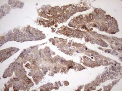 Immunohistochemistry: AAAS Antibody (OTI5B10) [NBP2-45540]