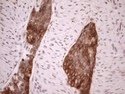 Immunohistochemistry: AAAS Antibody (OTI5B10) [NBP2-45540]