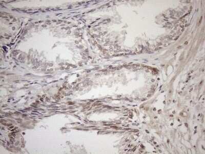 Immunohistochemistry: AAAS Antibody (OTI5B10) - Azide and BSA Free [NBP2-71358]