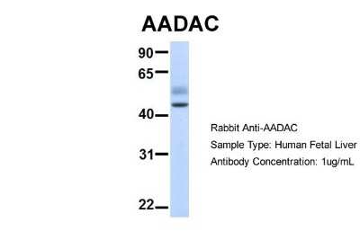 Western Blot: AADAC Antibody [NBP1-62428]