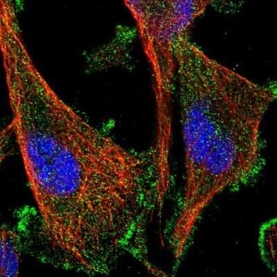Immunocytochemistry/ Immunofluorescence: AAK1 Antibody [NBP1-84110]