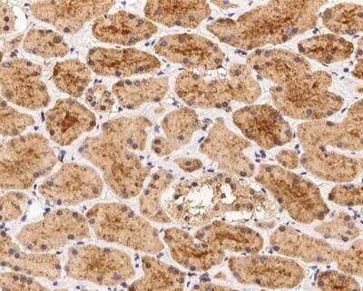 Immunohistochemistry-Paraffin: AAMP Antibody [NBP3-12703]