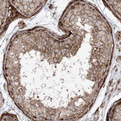 Immunohistochemistry-Paraffin: AARS2 Antibody [NBP1-89323]
