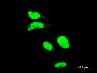 Immunocytochemistry/ Immunofluorescence: AATF Antibody (2H6) [H00026574-M09]