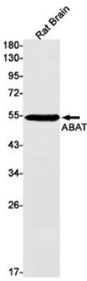 Western Blot: ABAT Antibody (S08-9E3) [NBP3-19553]