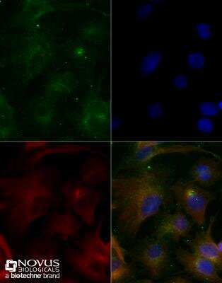 Immunocytochemistry/ Immunofluorescence: ABCA1 Antibody (1276B) - BSA Free [NBP2-54792]