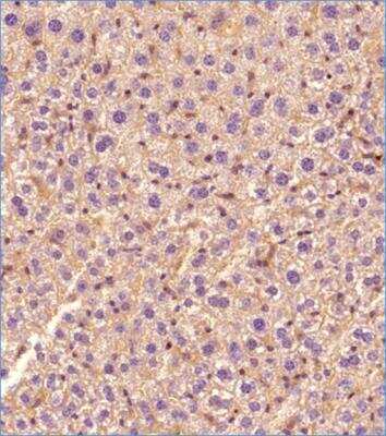 Immunohistochemistry-Paraffin: ABCA1 Antibody (1276B) - BSA Free [NBP2-54792]