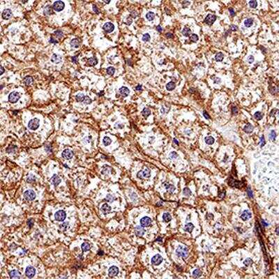 Immunohistochemistry-Paraffin: ABCA1 Antibody (3A1.891.3) [NB400-164]