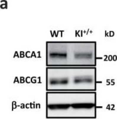 Western Blotting of ABCA1 in Peritoneal Macrophages from WT and KI+/+ Mice