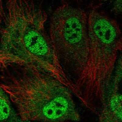 Immunocytochemistry/ Immunofluorescence: ABCA3 Antibody [NBP1-89310]