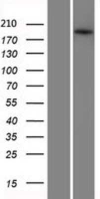 Western Blot: ABCA3 Overexpression Lysate [NBP2-08442]