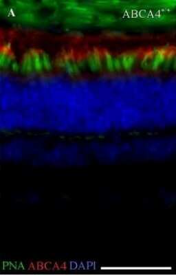 Immunohistochemistry: ABCA4 Antibody (3F4) [NBP1-30032]