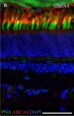 Immunohistochemistry: ABCA4 Antibody (3F4) [NBP1-30032]