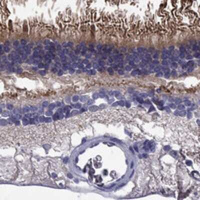 Immunohistochemistry-Paraffin: ABCA4 Antibody [NBP3-17333]