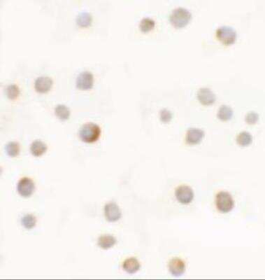 Immunocytochemistry/ Immunofluorescence: ABCA7 Antibody - BSA Free [NBP2-82069]