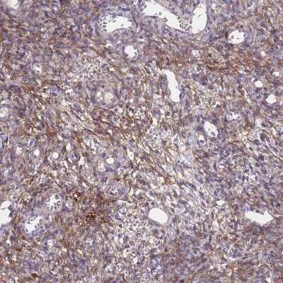 Immunohistochemistry-Paraffin: ABCA8 Antibody [NBP1-91641]