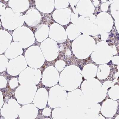 Immunohistochemistry: ABCB10 Antibody [NBP2-38749]