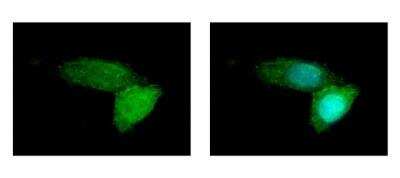Immunocytochemistry/ Immunofluorescence: ABCB11 Antibody [NBP1-31824]