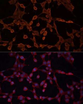 Immunocytochemistry/ Immunofluorescence: ABCB11 Antibody - Azide and BSA Free [NBP2-92689]