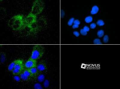 Immunocytochemistry/ Immunofluorescence: ABCB5 Antibody - BSA Free [NBP1-77689]