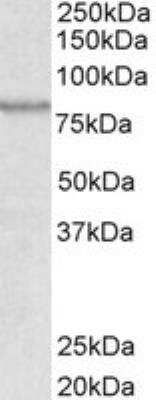 Western Blot: ABCB5 Antibody [NB100-93365]