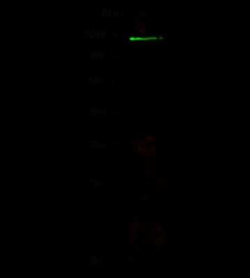 Western Blot: ABCB5 Antibody [NBP2-98737]