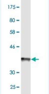 Western Blot: ABCB6 Antibody (3E1) [H00010058-M01]